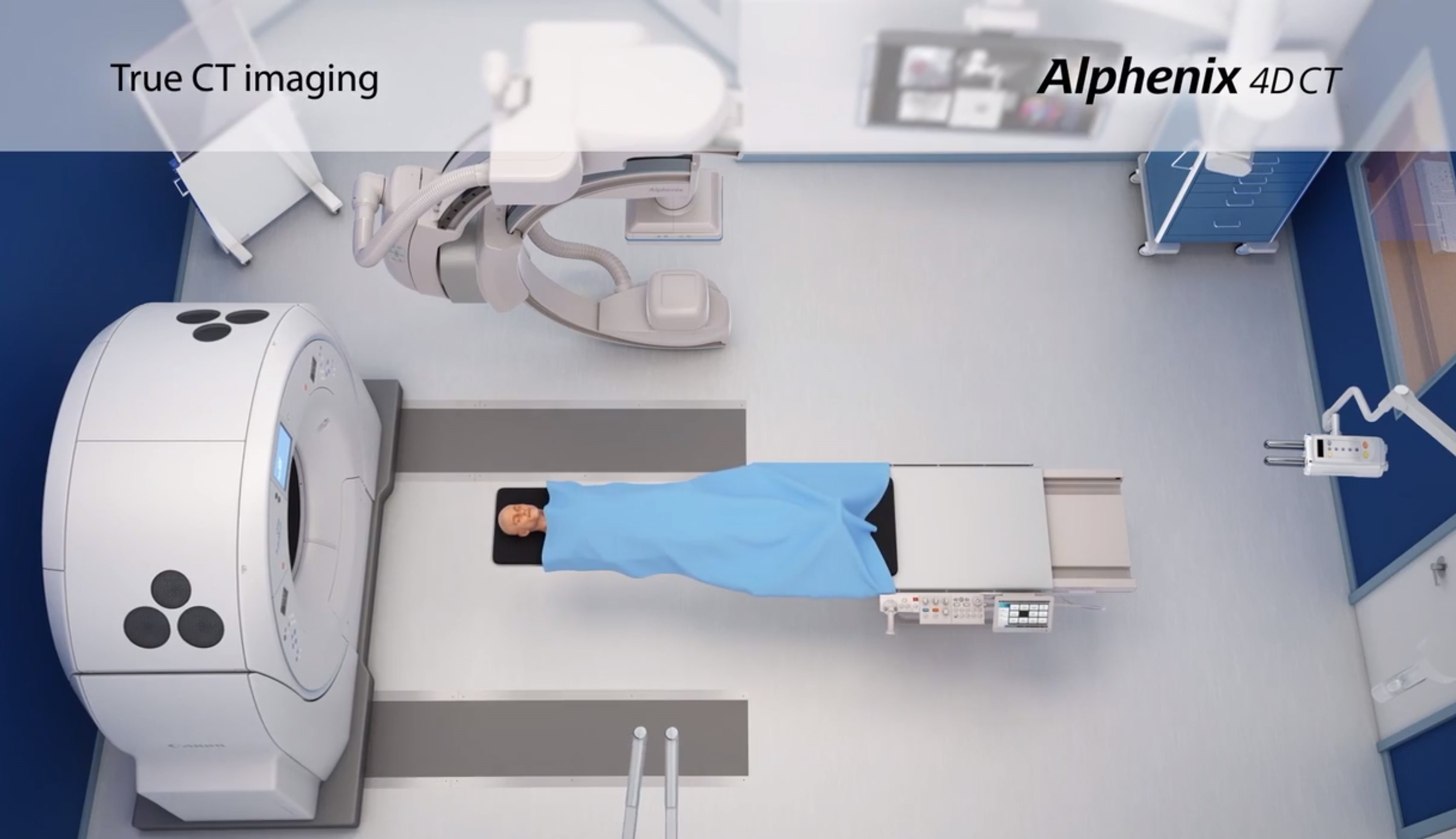 Alphenix 4D CT